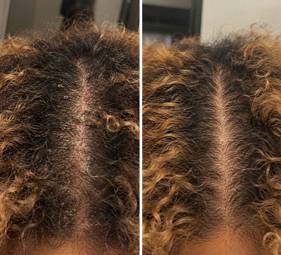 Estelle, 30 ans · Pointe-à-Pitre (Guadeloupe)