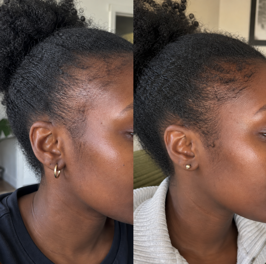 Mariam, 29 ans · Cayenne (Guyane)