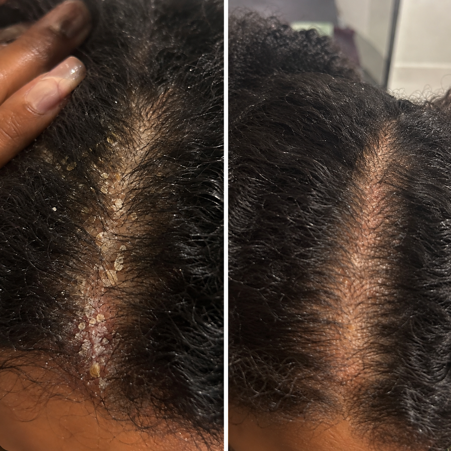 Nelly, 35 ans · Les Abymes (Guadeloupe)